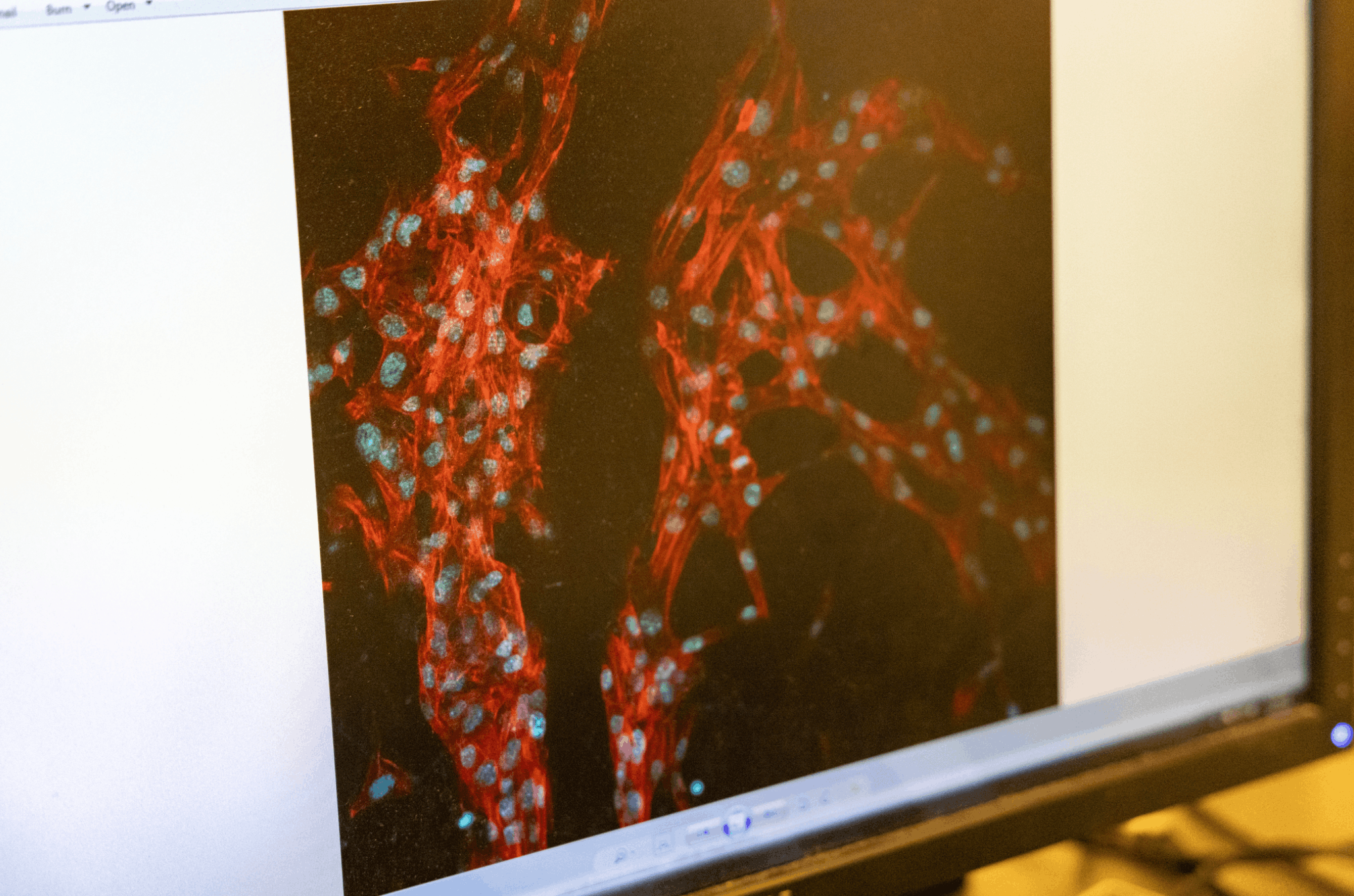 Microscope image showing red and blue stained cells on a dark background.