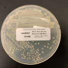 A yeast strain in a petri dish.